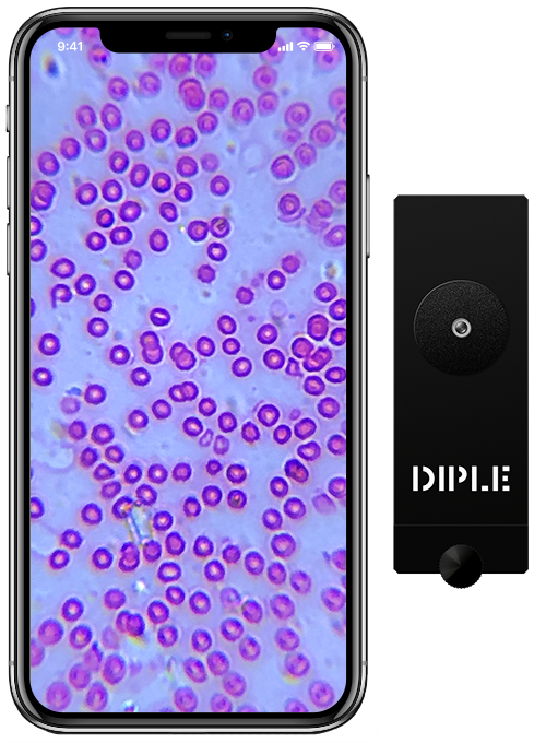 DIPLE - the POWERFUL microscope for any smartphone by SMO SmartMicroOptics  » FAQ — Kickstarter